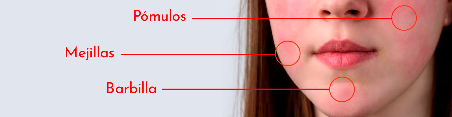 Imagen del formulario